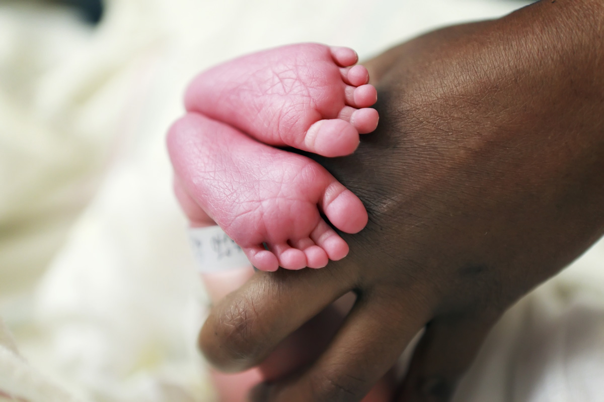 Normal newborn red feet. The color of the feet change with repositioning.