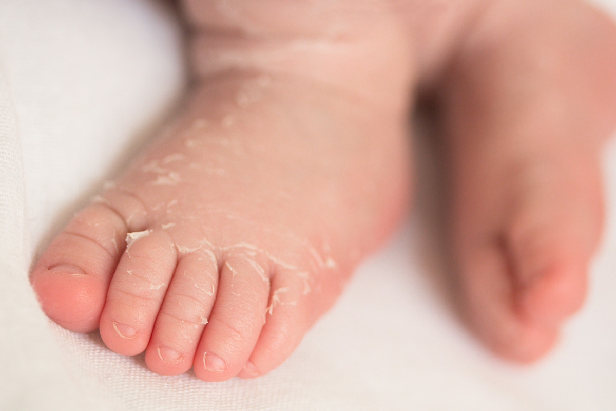 Newborn baby's feet with normal skin peeling.