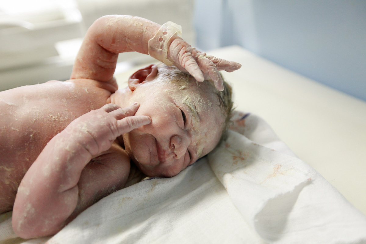 Newborn baby covered with vernix, a protective coating from the womb.